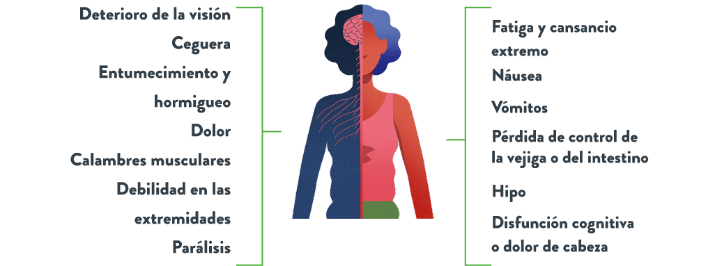 Diagrama que muestra los síntomas del trastorno de espectro neuromielitis óptica (NMOSD), que incluyen deterioro de la visión, ceguera, dolor, calambres musculares, parálisis, debilidad, náuseas, vómitos, pérdida del control de la vejiga o los intestinos, hipo, somnolencia excesiva y problemas respiratorios