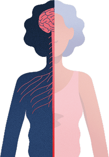 Diagrama anatómico del cuerpo de una mujer que muestra el impacto del NMOSD en el sistema nervioso central